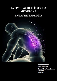 2020_t_estimulacio_electrica.jpg